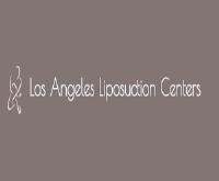Los Angeles Liposuction Centers image 1