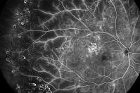 High Country Macula, Retina, and Vitreous, PC image 3