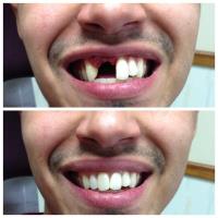 Grishin Denture Specialist image 3