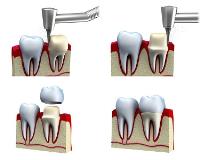 Advanced Family Dentistry image 3