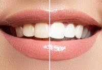 Hollander Dental Associates image 2