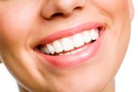 Carte Blanche Teeth Whitening Los Angeles image 3