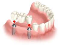 Hill Dentistry image 3