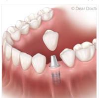  Meadowdale Dental Clinic image 1
