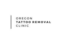 Oregon Tattoo Removal Clinic image 1