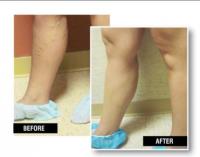 USA Vein Clinics image 4