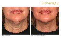 Sculpted Contours Luxury Medical Aesthetics image 6