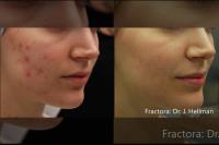 Sculpted Contours Luxury Medical Aesthetics image 4