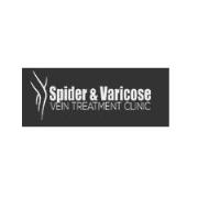 Spider and Varicose Vein Treatment Clinic image 1