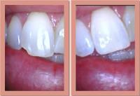 Westbank Dental image 4