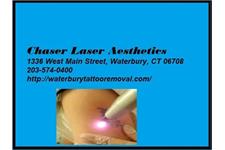  Chase Laser Aesthetics image 5