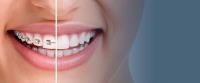 Advanced Orthodontics , Dr. Ferreira image 3