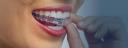 Advanced Orthodontics , Dr. Ferreira logo