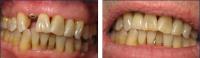Sabal Dental - Alameda image 3