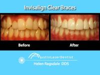 Austin Laser Dentist - HelenRagsdale DDS image 4