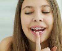Orthodontic Experts of Colorado image 2