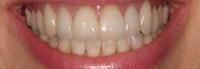 Olympia Prosthodontics & Cosmetic Dentistry image 12