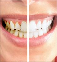 Olympia Prosthodontics & Cosmetic Dentistry image 7