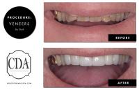 Consultants in Dental Aesthetics image 4