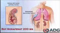 Buy Sorafenat 200 mg image 1