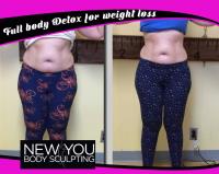 New You Body Sculpting image 2
