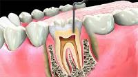 National Dental Hicksville image 3