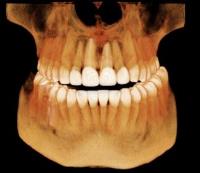 Medicare Medicaid Dentist Jupiter FL image 20