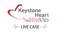Keystone Heart image 3