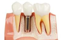 National Dental Douglaston image 6