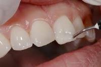 National Dental Douglaston image 7
