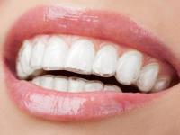 The Happy Tooth Orthodontics image 2