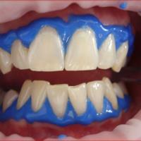 Park Avenue Gentle Dental: Dr. Harsha Patel DDS image 5