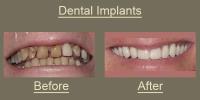 McBride Dental image 3