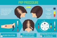 Prp Treatment For Hair Loss image 2