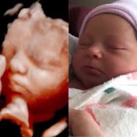 Baby Zoom 4D Ultra Sound & Photography image 2