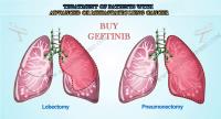 Buy Gefticip 250 mg image 5