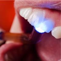 Right Care Dental image 7