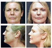The Gallery of Cosmetic Surgery image 2