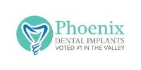 Phoenix Dental Implants image 1