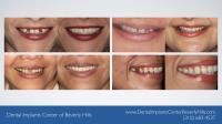 Dental Implants Center of Beverly Hills image 5