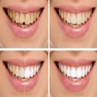 Cosmetic Dentist Scottsdale Experts image 1