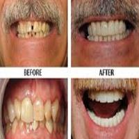Cosmetic Dentist Scottsdale Experts image 3