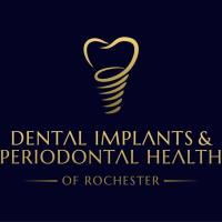 Dental Implants & Periodontal Health image 2