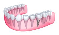 Sinai Dental Group image 7