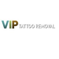 VIP Tattoo Removal - Las Vegas image 1