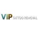 VIP Tattoo Removal - Las Vegas logo
