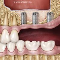 Dr. Moazed and Wang Dental Office image 2