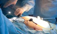 Dr Arvind Kumar | Laparoscopic Oncosurgery image 8