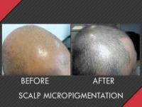 MAXiM Hair Restoration image 3