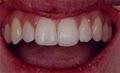 Dentist Katy image 4